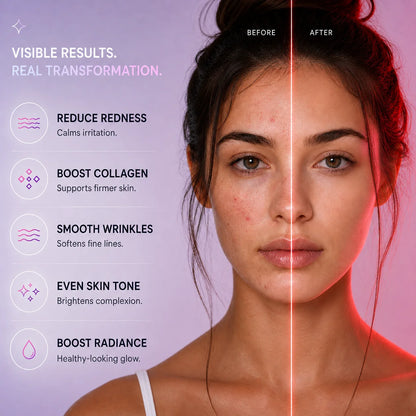 Wrinkle Retreat Pro LED Face Mask